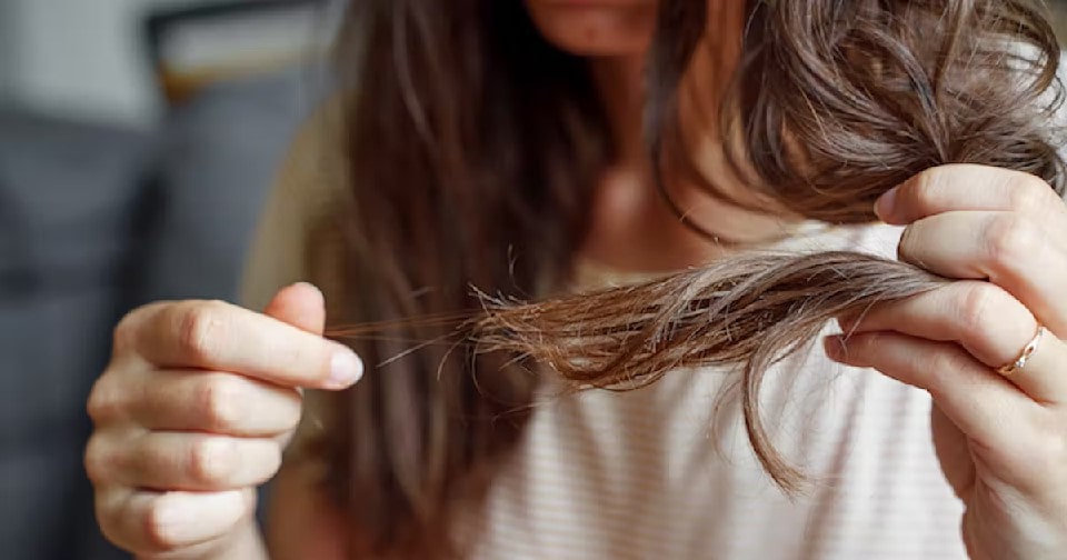 Các nguyên nhân rụng tóc nhiều phổ biến nhất 3
