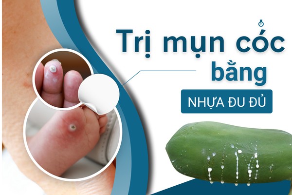 Trị mụn cóc bằng mủ đu đủ xanh có được không? 2