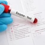 Rối loạn chuyển hóa enzyme là gì, có nguy hiểm không?